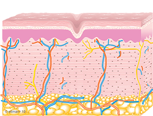 Tempsure skin illustration | Ideal Wellness & Aesthetics